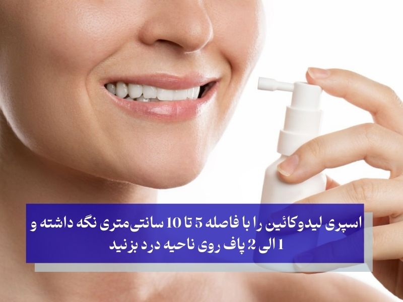نحوه مصرف اسپری لیدوکائین برای دندان