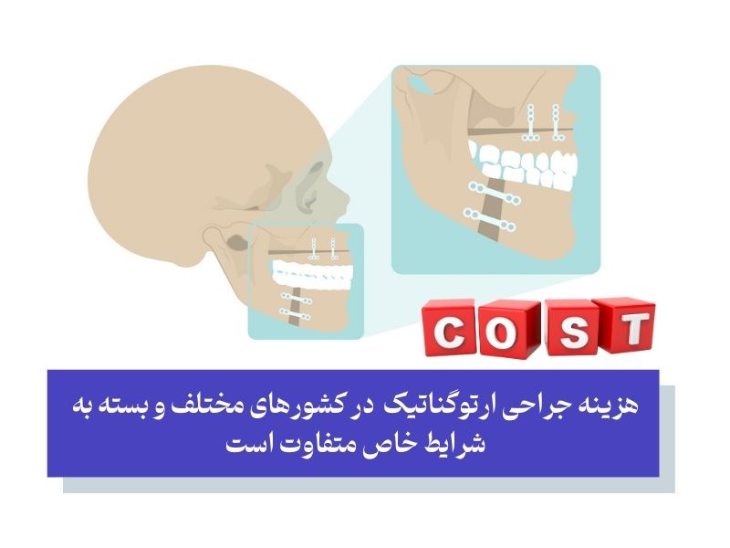 هزینه جراحی ارتوگناتیک