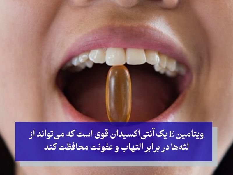 ویتامین E و نقش آن در کاهش التهاب لثه‌ها