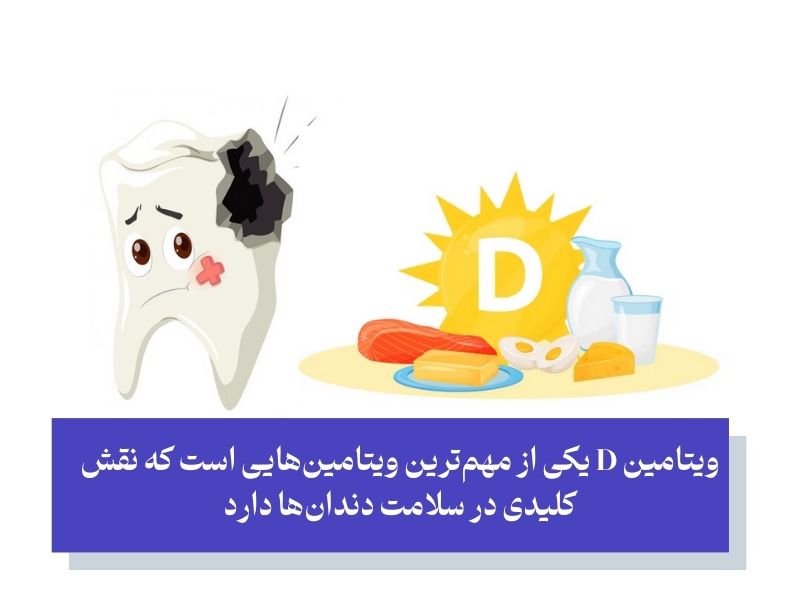 کمبود ویتامین D و پوسیدگی دندان: آیا این ویتامین از پوسیدگی جلوگیری می‌کند؟