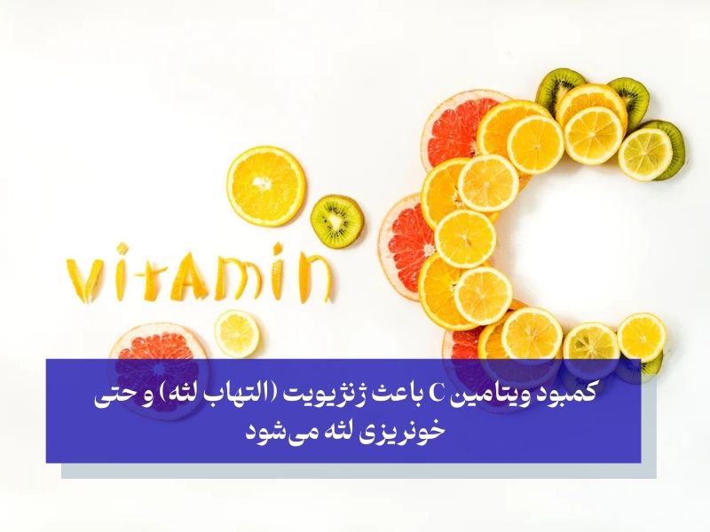 کمبود چه ویتامینی و سیاه شدن لثه