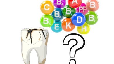 کمبود کدام ویتامین باعث پوسیدگی دندان میشود