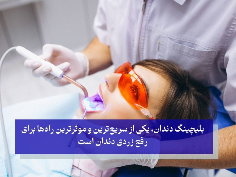 بلیچینگ دندان برای رفع زردی در یک روز