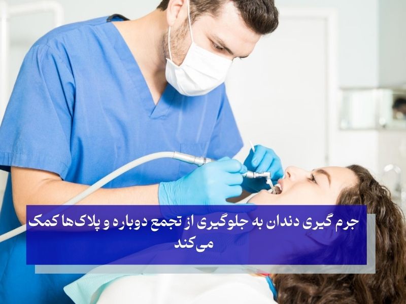 مراحل جرم گیری دندان برای از بین رفتن زردی