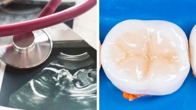 پر کردن دندان در بارداری