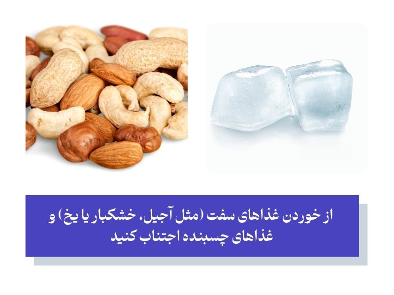 تغذیه برای مادران بعد از پر کردن دندان در بارداری