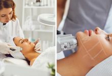 تفاوت فیشیال و هایفو چیست