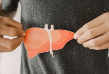 برای پاکسازی کبد چرب چی بخوریم