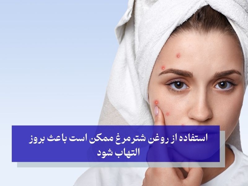 استفاده از روغن شترمرغ ممکن است باعث بروز التهاب شود