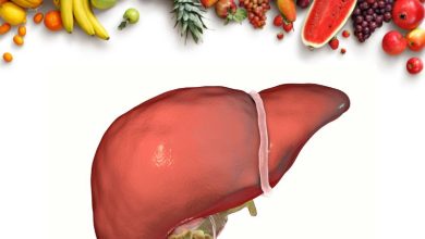 میوه های مضر برای سنگ کیسه صفرا