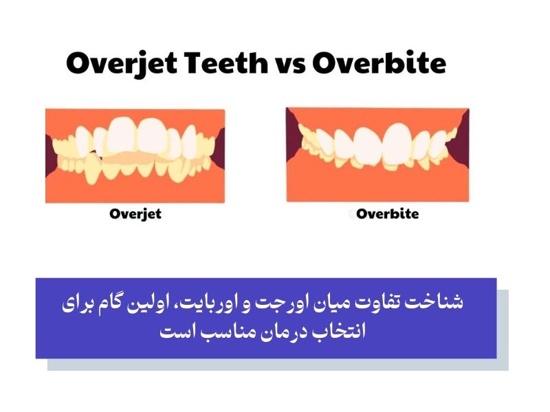 اوربایت و اورجت