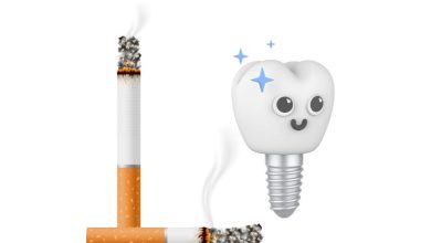 تاثیر سیگار بر ایمپلنت
