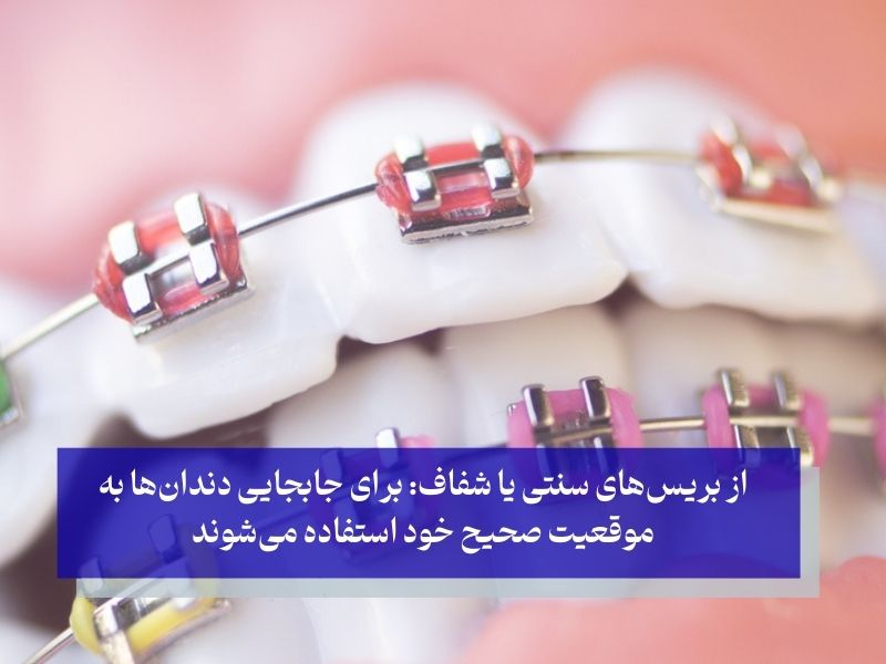 درمان اوربایت در بزرگسالان