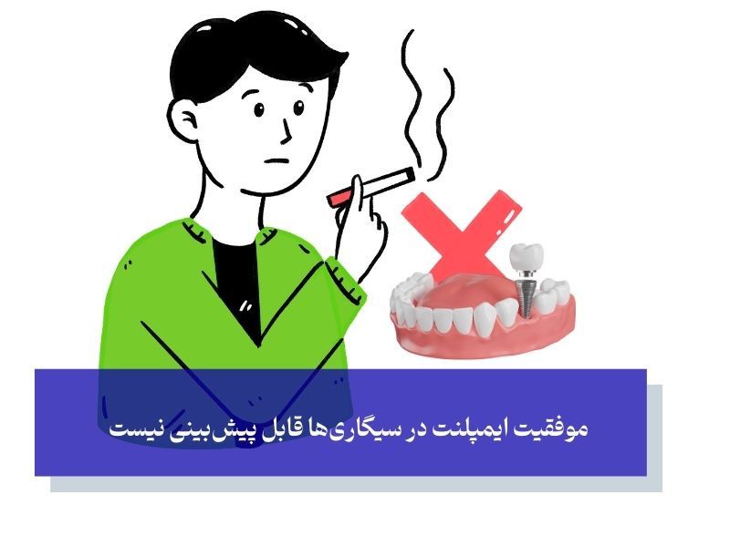 دیدگاه جراحان و متخصصان ایمپلنتولوژی؛ بدون ترک سیگار، هیچ ضمانتی نیست!