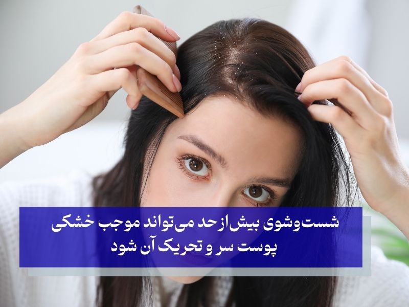 شست‌وشوی بیش‌ازحد موی سر عامل تحریک پوست سر و ایجاد شوره