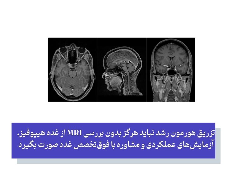 وقتی تزریق هورمون رشد به‌موقع نباشد