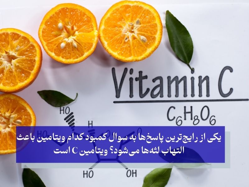 ویتامین C