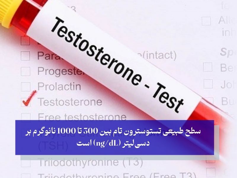 چطور کمبود تستوسترون را تشخیص دهیم