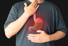 چه چیزهایی اسید معده را زیاد میکند