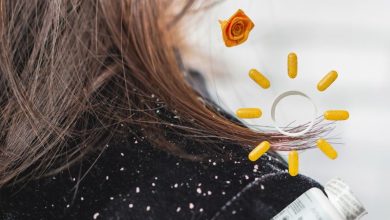 کمبود کدام ویتامین باعث شوره سر میشود