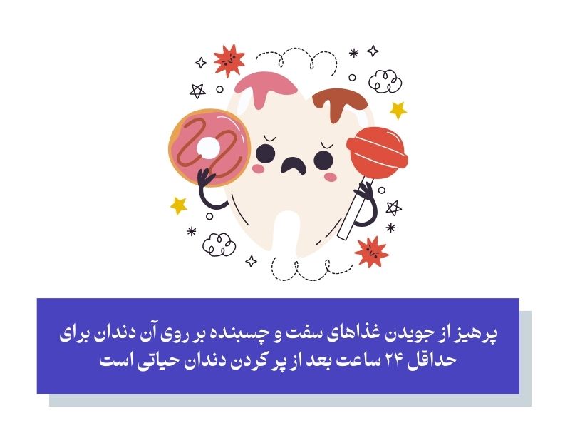 چند ساعت بعد از پر كردن دندان بايد غذا خورد