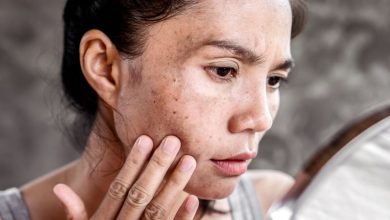 سریع‌ترین راه از بین بردن لک قهوه‌ای صورت