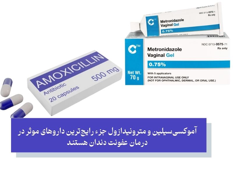 مترونیدازول و اموکسی سیلین برای عفونت دندان