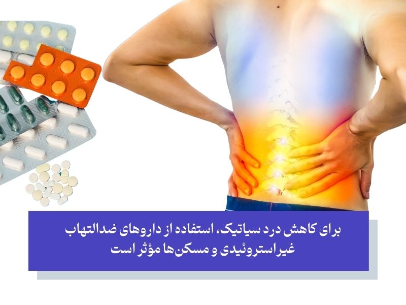 داروهای مسکن برای سیاتیک