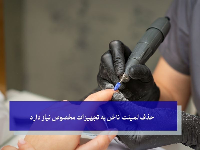 حذف لمینت ناخن به تجهیزات مخصوص نیاز دارد