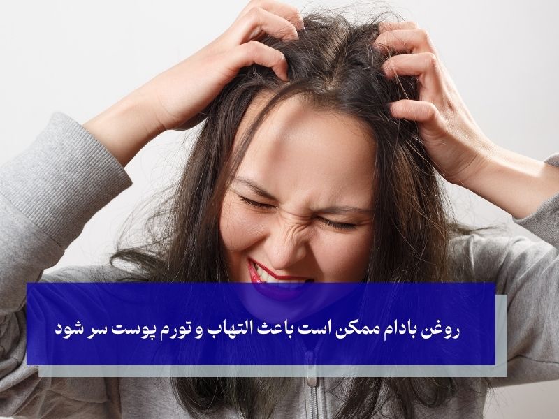 روغن بادام ممکن است باعث التهاب و تورم پوست سر شود