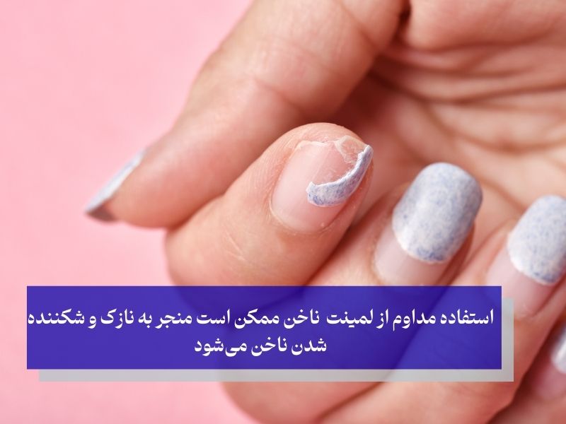 استفاده مداوم از لمینت ناخن ممکن است منجر به نازک و شکننده شدن ناخن می‌شود
