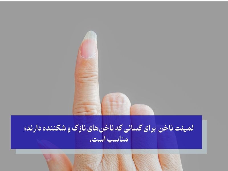 لمینت ناخن برای کسانی که ناخن‌های نازک و شکننده دارند؛ مناسب است.