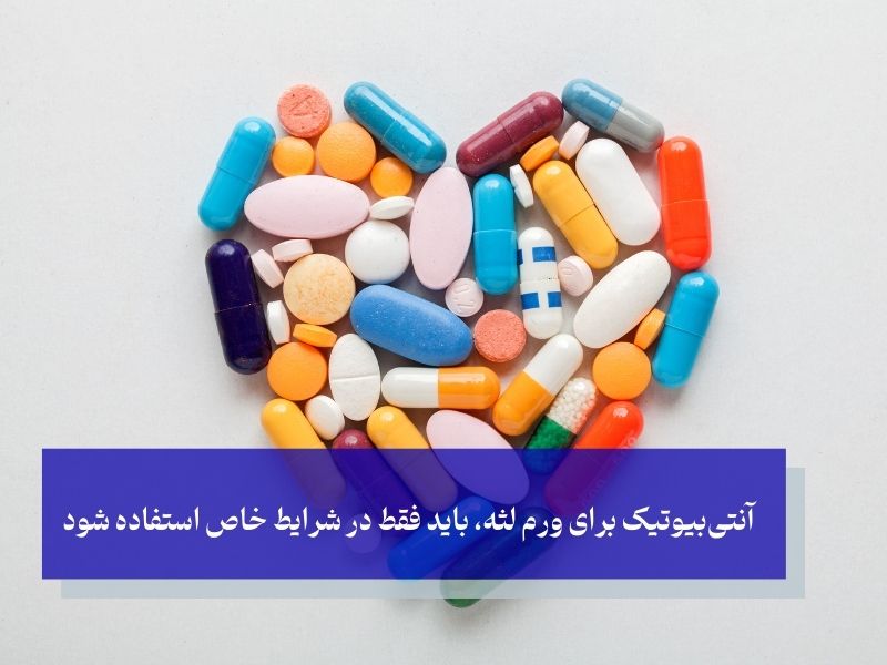 آنتی‌بیوتیک‌ها؛ دوست یا دشمن ورم لثه