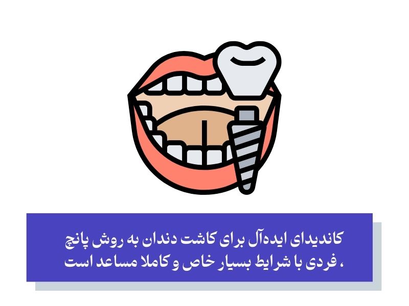 آیا کاشت دندان به روش پانچ واقعا برای همه مناسب است