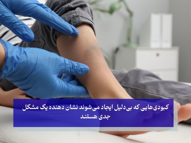 آیا کبودی بدن خطرناک است؟