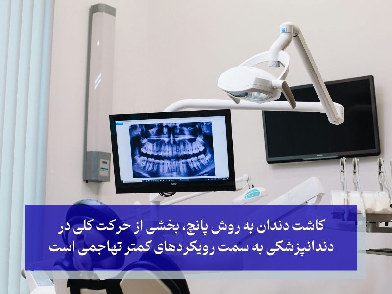 آینده ایمپلنت‌های دندانی