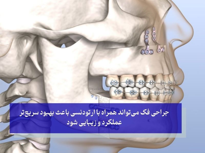 ارتودنسی سریع یا جراحی فک