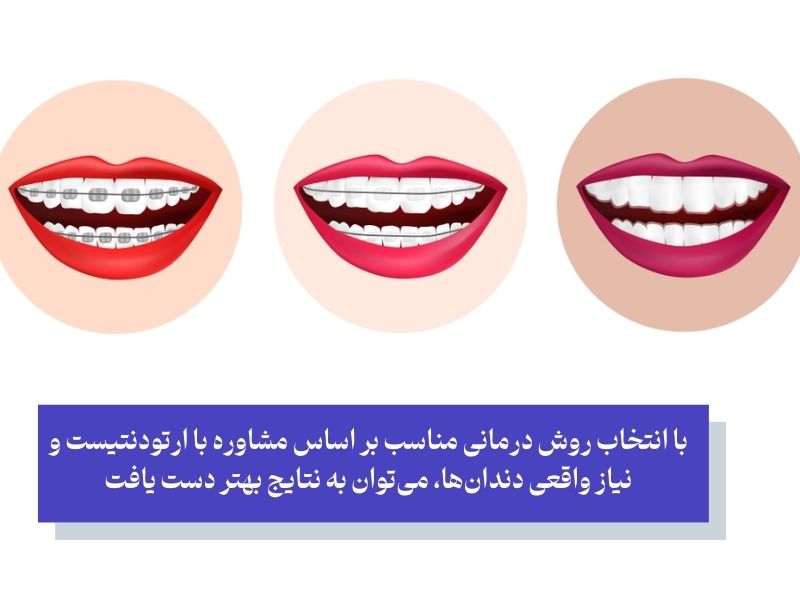 اولین گام برای کاهش زمان ارتودنسی