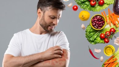 برای خارش بدن چه بخوریم