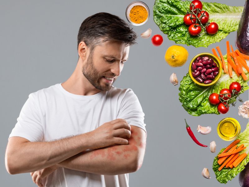 برای خارش بدن چه بخوریم