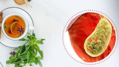 برای دفع سنگ کیسه صفرا چه بخوریم؟