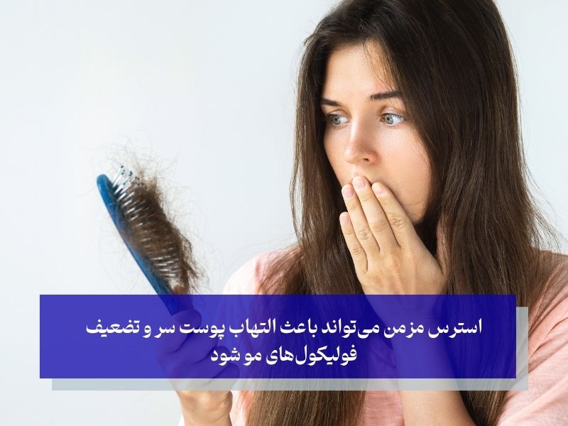 تاثیر استرس بر ریزش مو