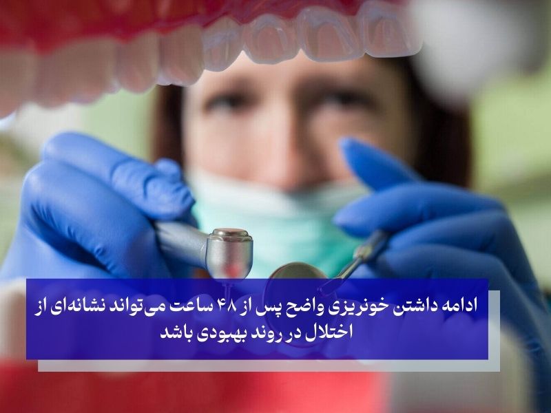 خونریزی بعد از ایمپلنت دندان