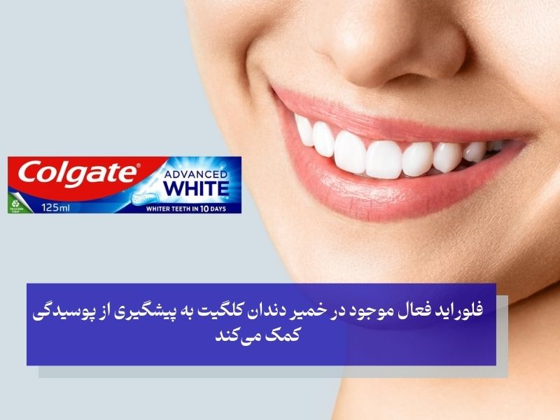 خمیر دندان کلگیت برای کامپوزیت