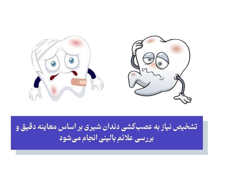 دلایل نیاز به عصب ‌کشی دندان کودکان