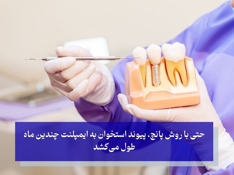 دوره نقاهت و مراقبت‌های بعد از کاشت دندان به روش پانچ