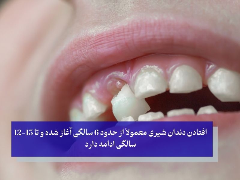 زمان دقیق افتادن دندانهای شیری