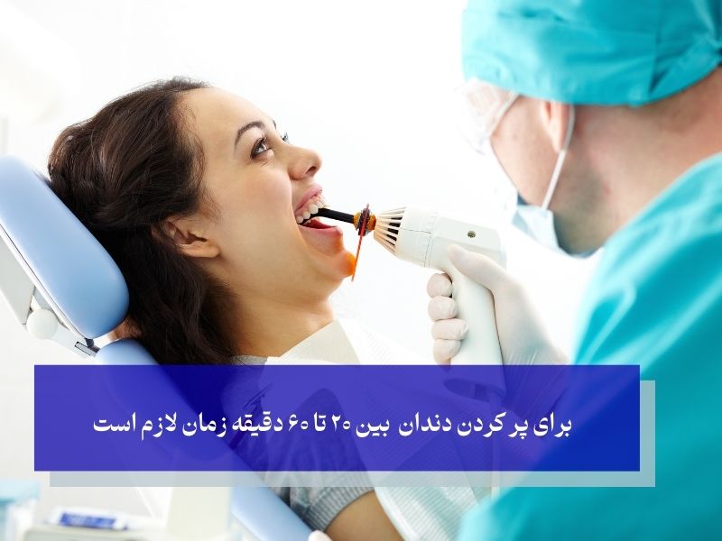 مدت زمان پر کردن دندان