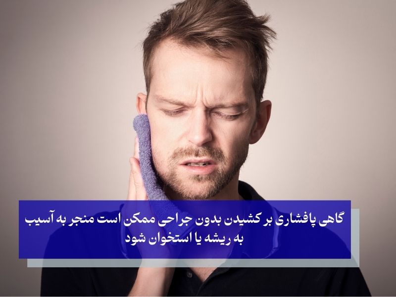 مزایا و معایب کشیدن دندان عقل بدون جراحی