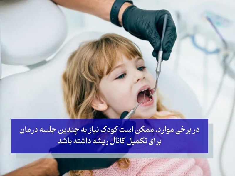 مضرات عصب کشی دندان کودکان
